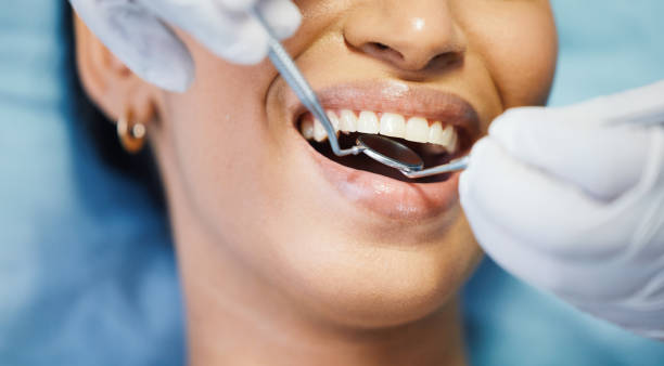 Best Walk-In Emergency Dental Services in Varnville, SC